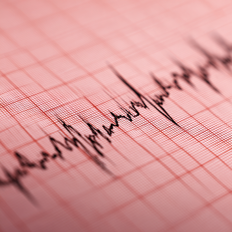 Ein Ausdruck eines EKGs welches im PVZ St Anna Wels gemacht wurde
