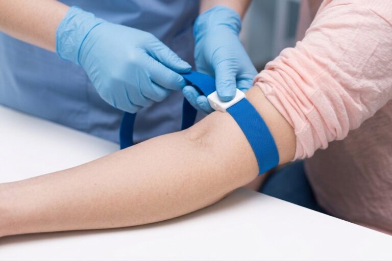 Ein blaues Band wird um den Oberarm gelegt, damit das Blut zur Blutabnahme gestaut wird.